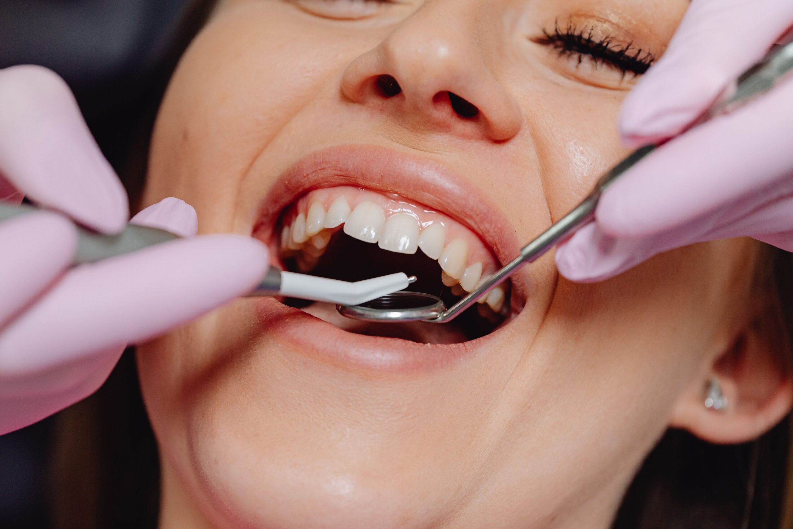 Paciente sonriendo en Luz Clínica Dental